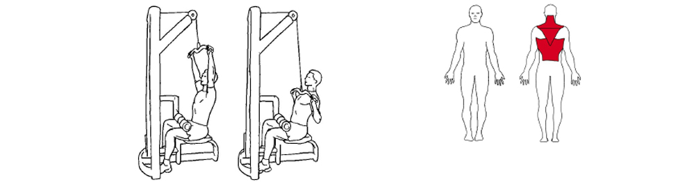 Illustrasjon viser utførelse av nedtrekk øvelse